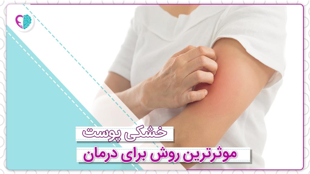 درمان خشکی پوست